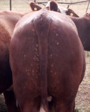 Image of nodules perineum