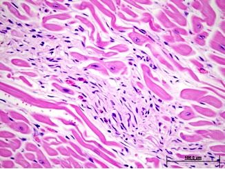 histopathology image of heart tissue