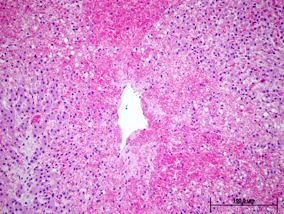 histopathology image of liver tissue