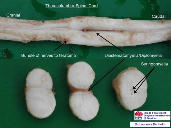 Image of post-mortem view of spinal cord and sections