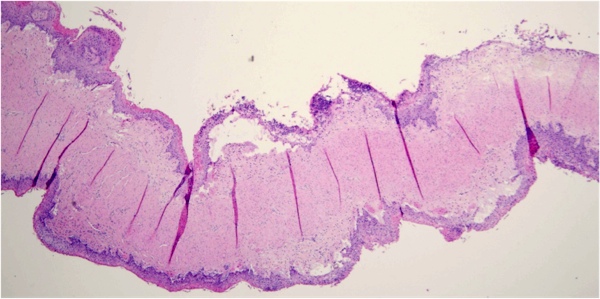 Histopathology image of section of bovine abomasum