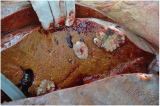 Image of cut surface of bovine liver showing abnormalities