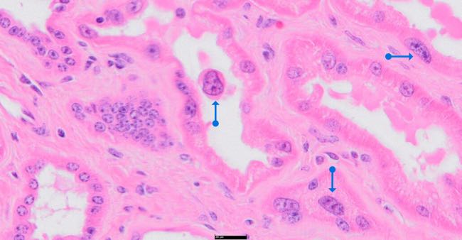 Photomicrograph of bovine kidney showing megalocytosis and karyomegaly