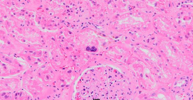 Photomicrograph of bovine kidney showing tubular necrosis