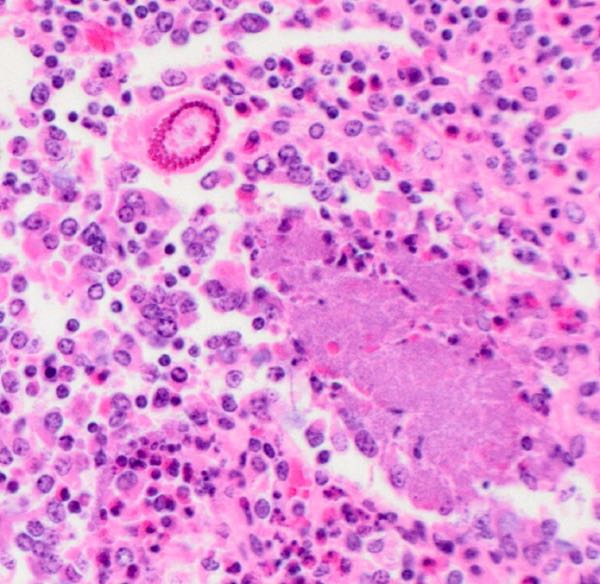 Photomicrograph of cow small intestine with schizont and bacterial colonies
