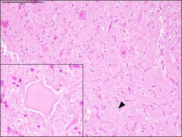 Microscopic image of caprine cervical spine grey matter