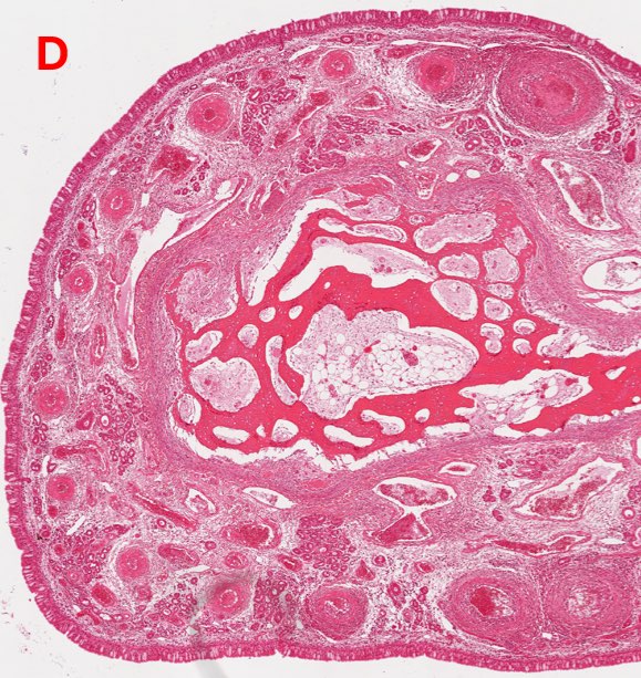Photomicrograph of sheep nasal turbinates showing vasculitis