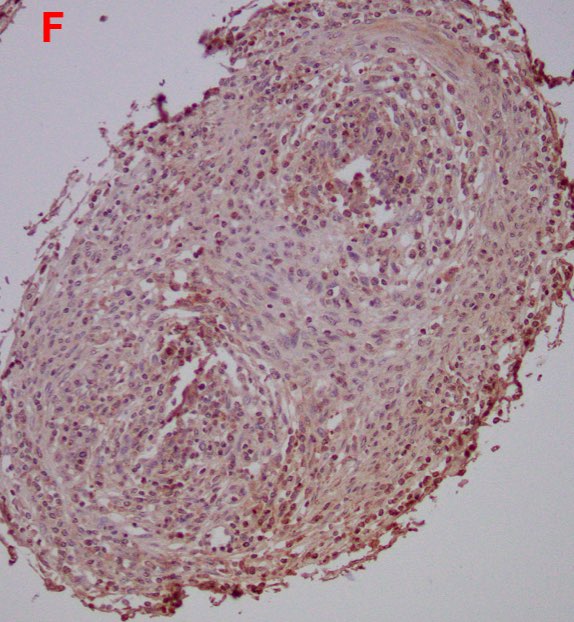 Photomicrograph showing histochemical staining for antibodies