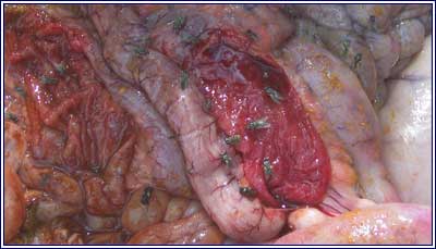 Image of sectioned sheep caecum post-mortem