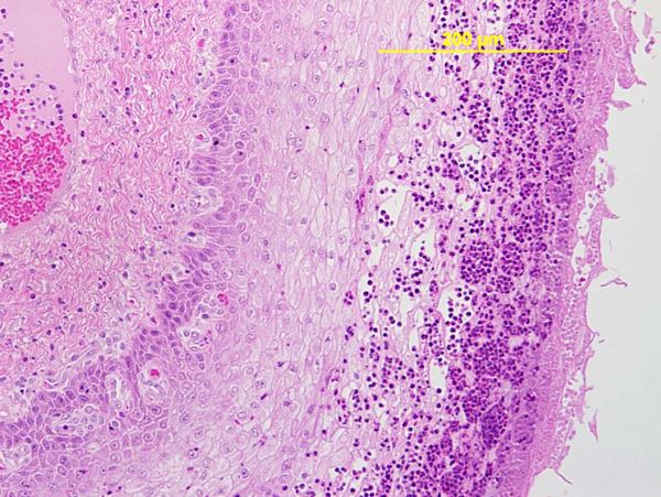 Photomicrograph of sheep oesophagus