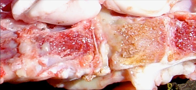 Image of sectioned sheep vertebral abscess post-mortem