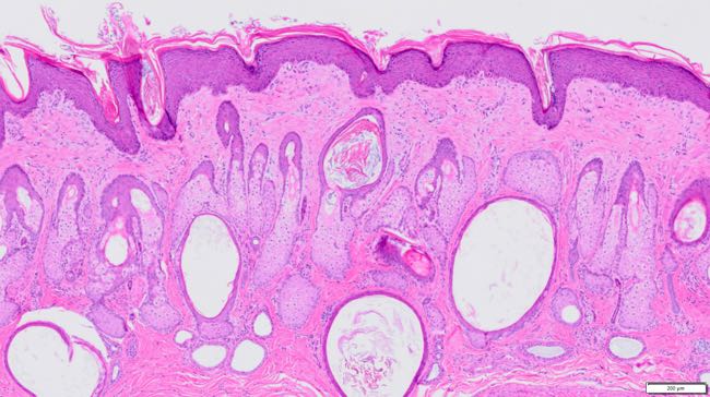 Photomicrograph of sheep skin with alopecia