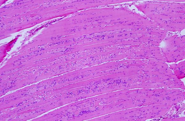 Photomicrograph of ovine myonecrosis