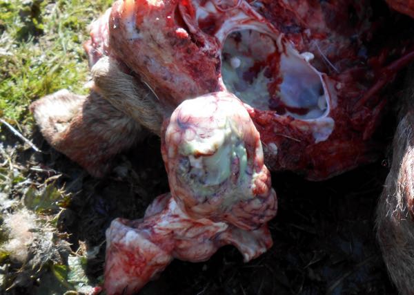 bacterial meningitis brain and cranial cavity