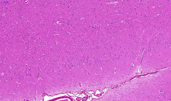 phalaris sudden death lambs histopathology normal cerebrocortex