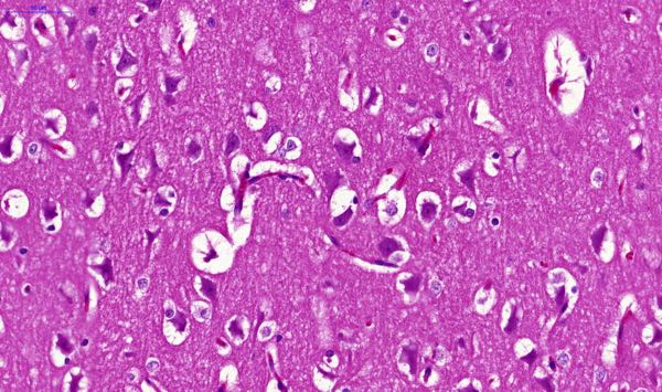 phalaris sudden death lambs affected lamb histopathology higher resolution
