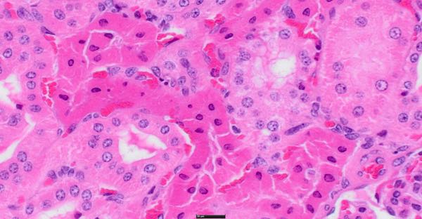 Photomicrograph of ovine kidney showing tubular necrosis